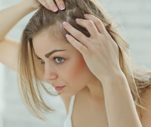 mulher sofrendo com a queda de cabelo depois de contrair COVID 19