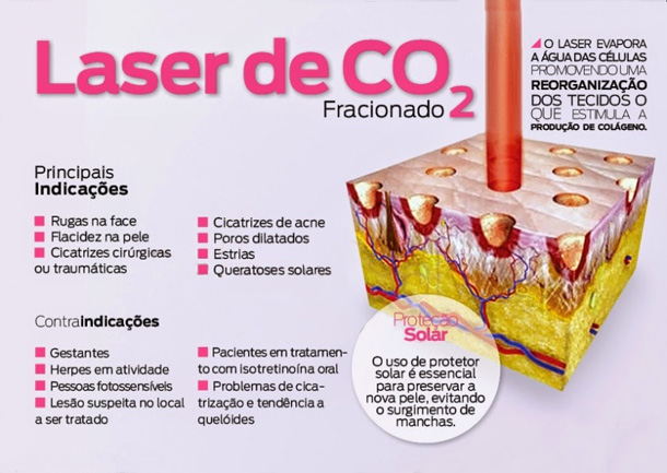 Gráfico com explicações sobre o Laser de CO2